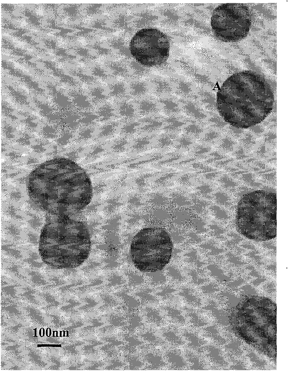 PEG-PLGA nanoparticle carrying recombinant human vascular endothelial inhibitor and preparation method thereof