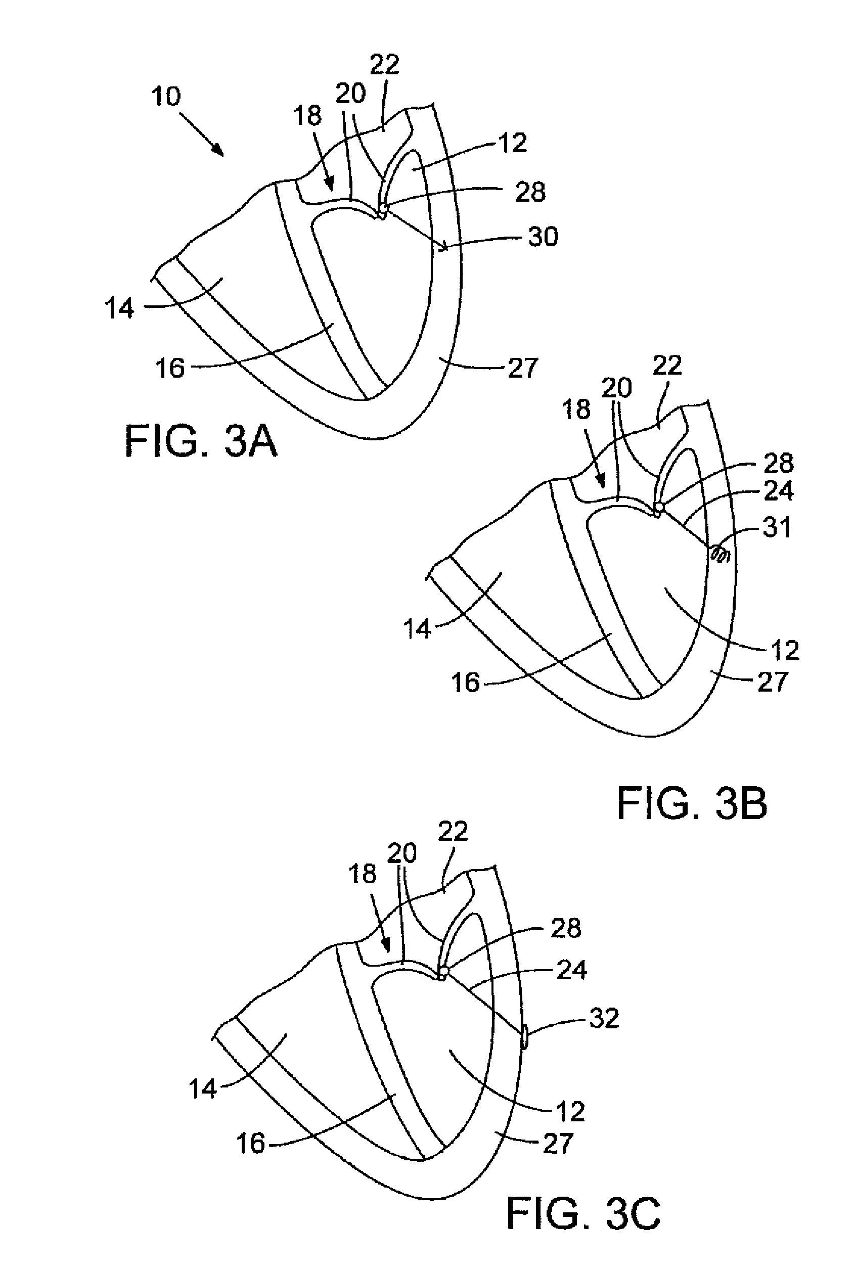 Method and apparatus for repairing or replacing chordae tendinae