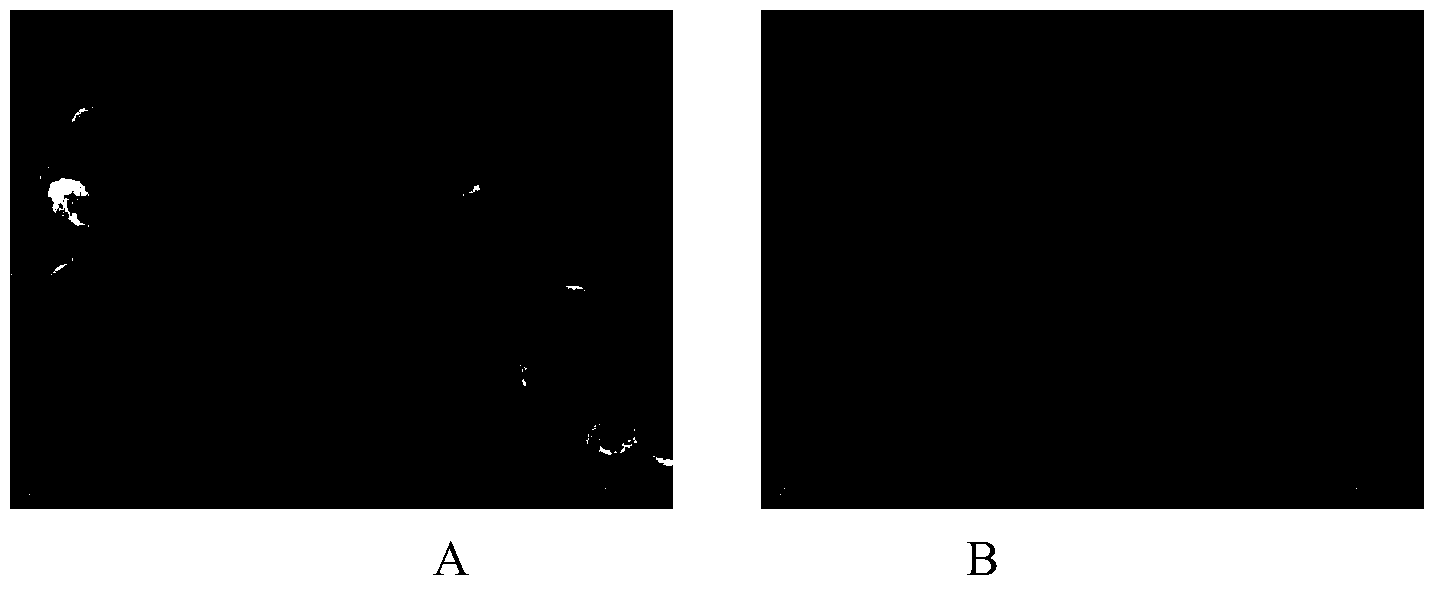 Preparation of hierarchically porous molecular sieve supported metal catalyst and application thereof in grease hydrodeoxygenation