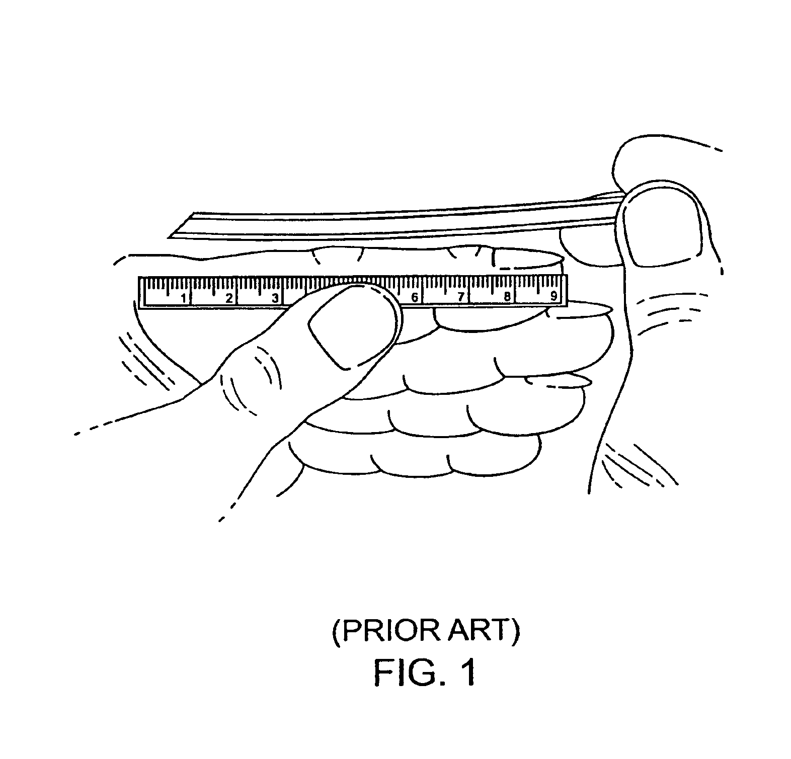 Endotracheal tube