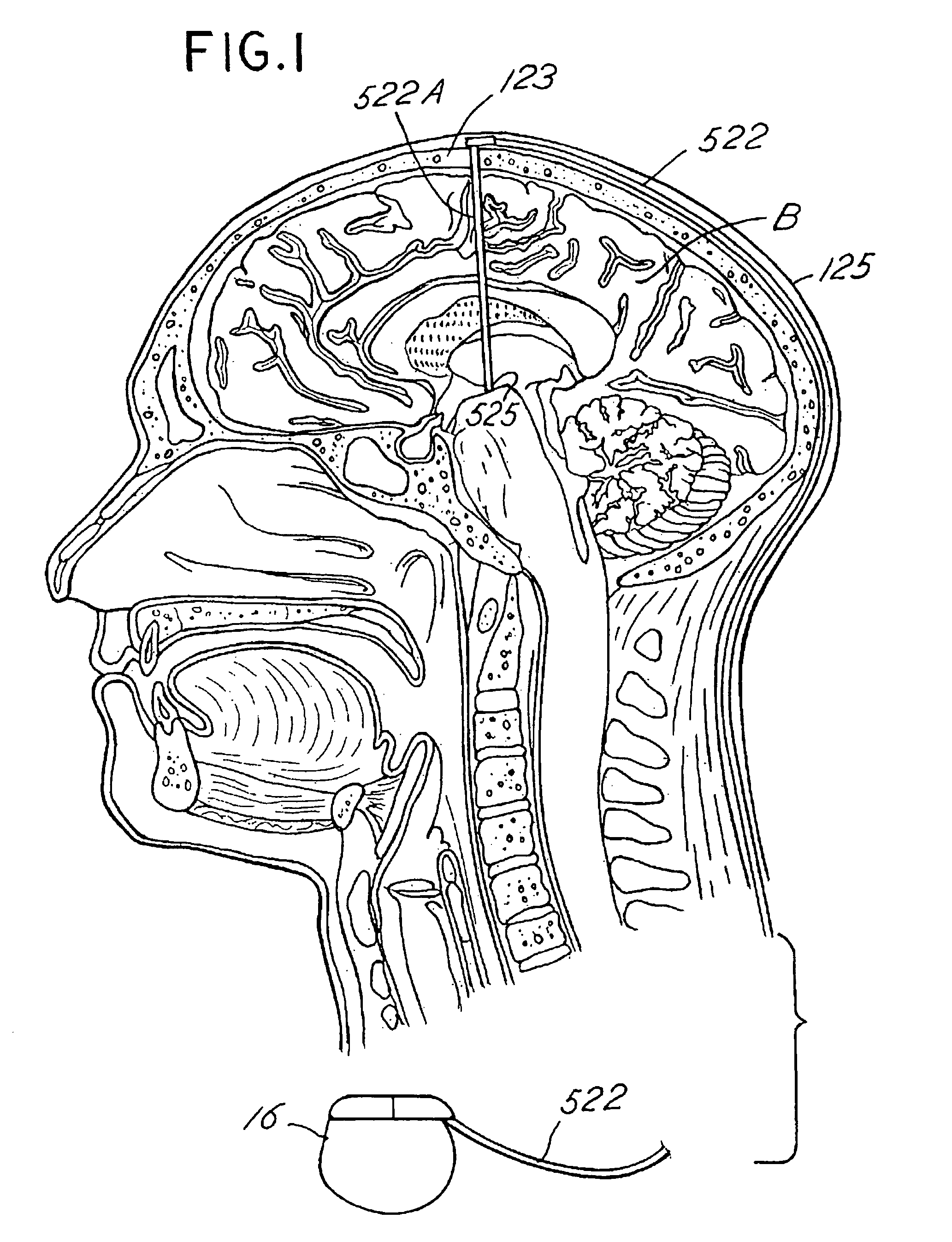 Regulation of neurotrophins