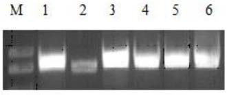 Construction and electrotransformation method of photosynthetic bacteria rhodopseudomonas palustris fluorescent GFP marker vector