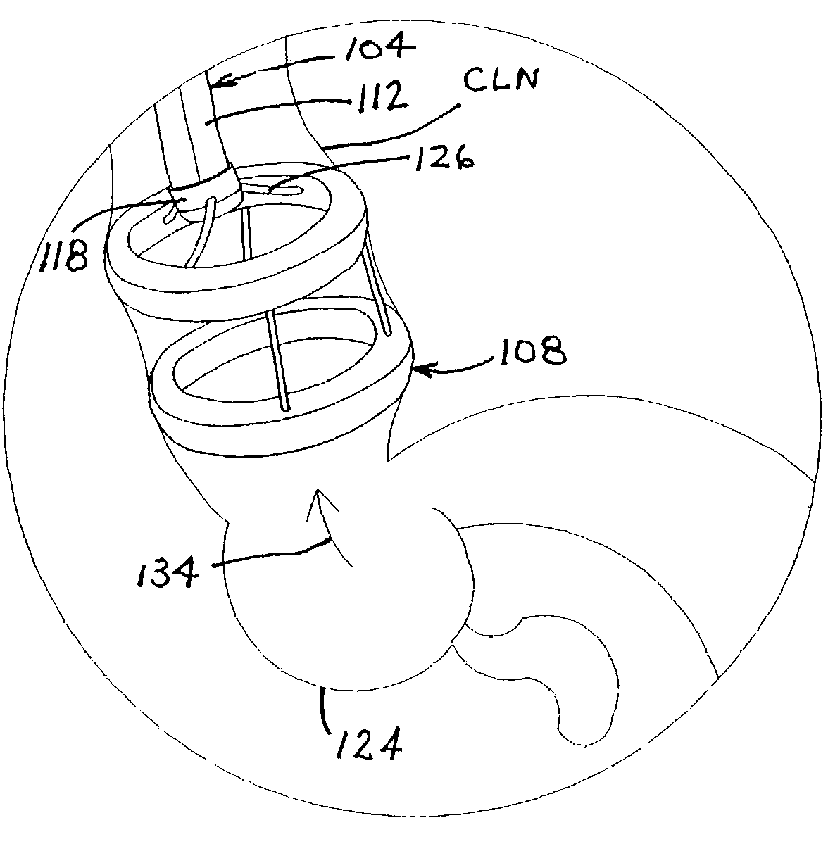 Endoscopic retractor instrument and associated method