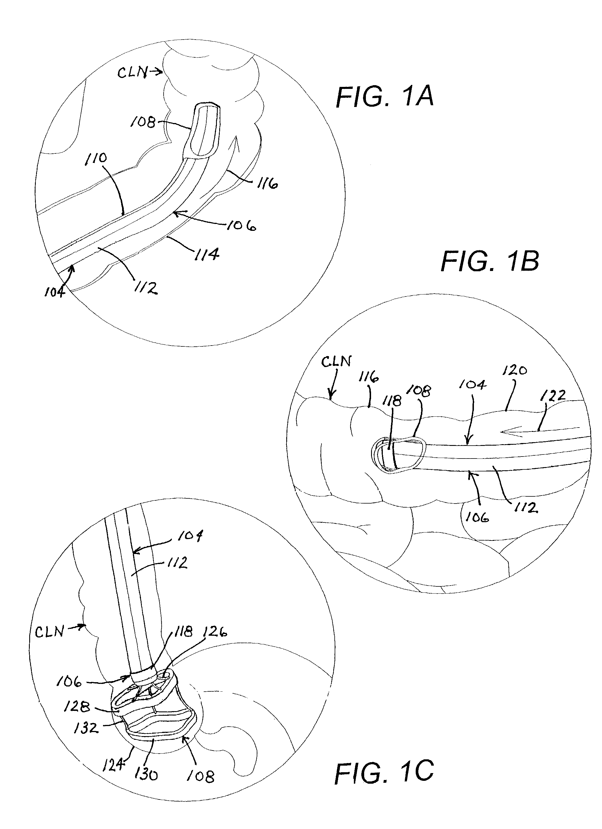 Endoscopic retractor instrument and associated method