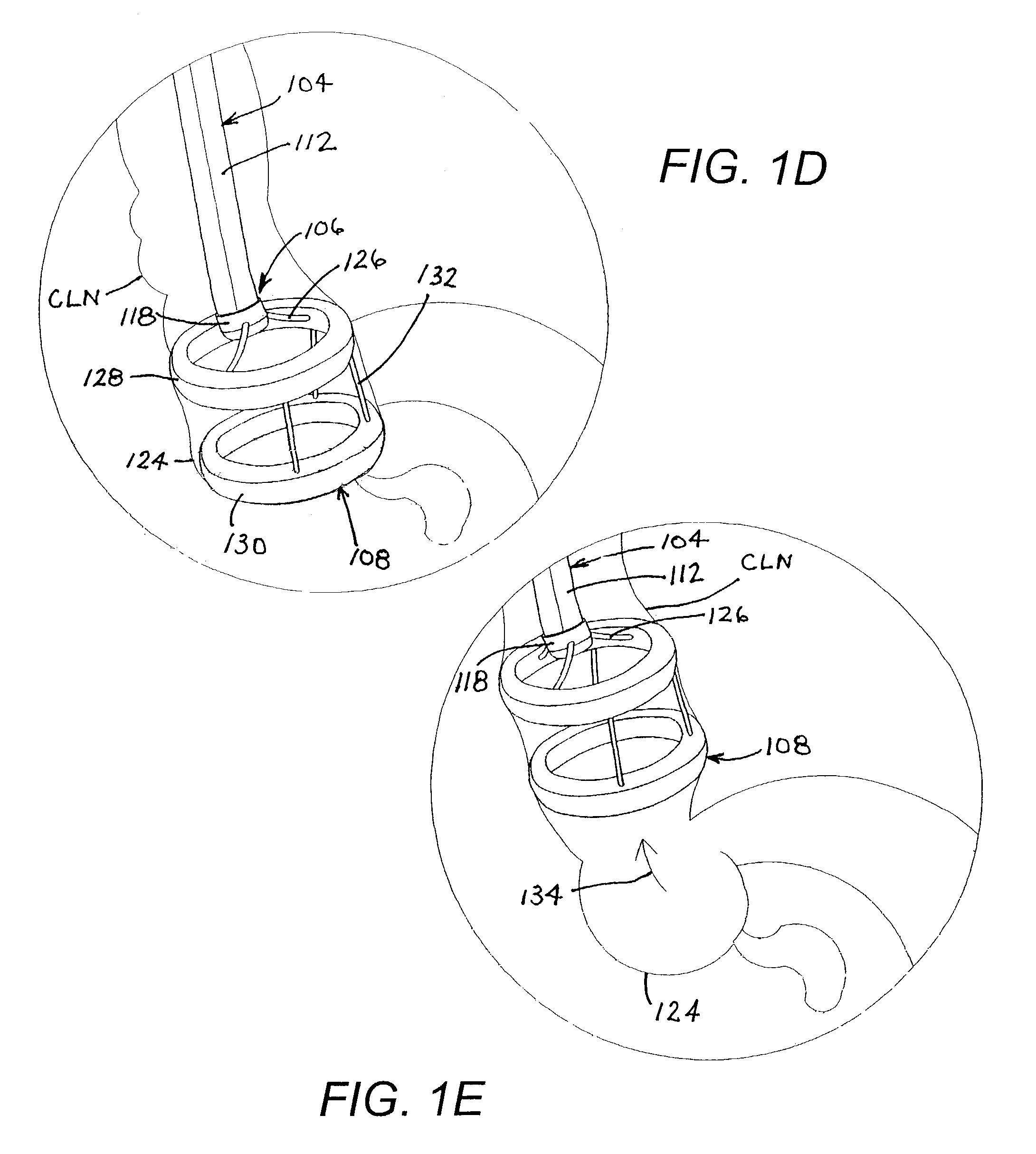 Endoscopic retractor instrument and associated method