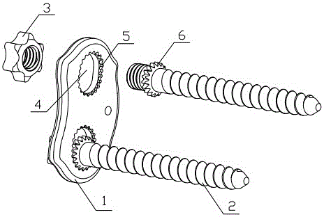 Longitudinal fine-tuning and compression device of anterior thoracolumbar spine plate