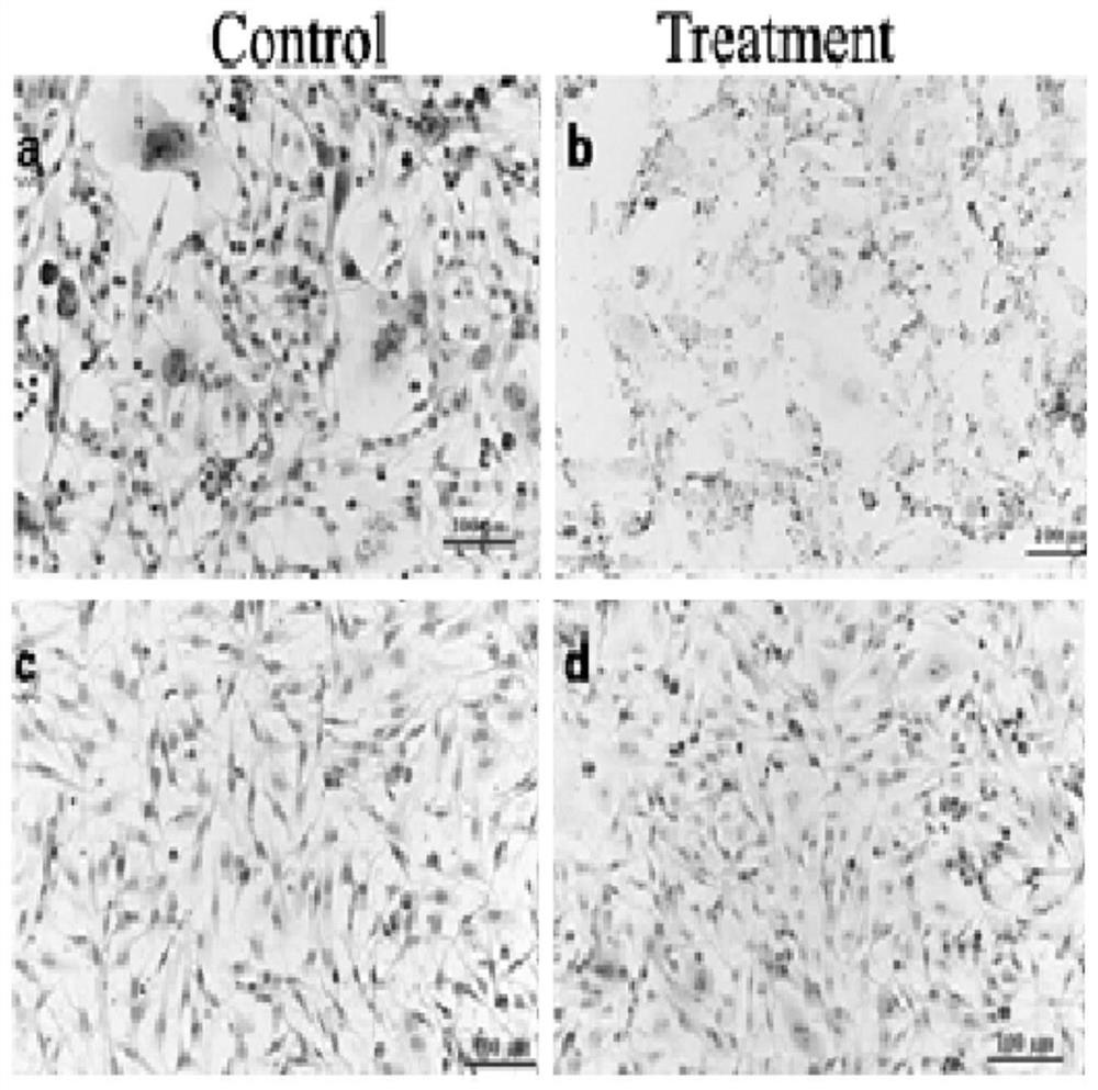 Use of dexamethasone, rosiglitazone, and 3-isobutyl-1-methylxanthine composition in the preparation of drugs for inhibiting the growth and metastasis of ovarian cancer cells induced by cobalt chloride