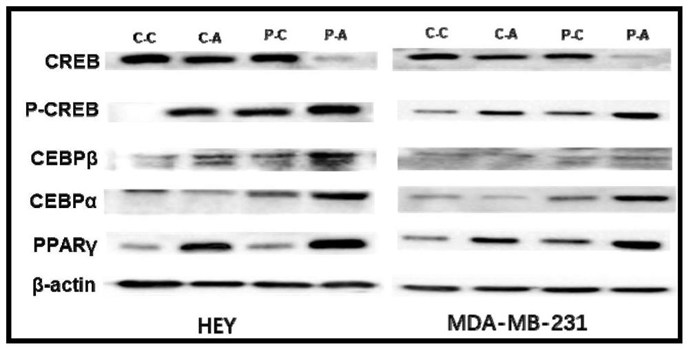 Use of dexamethasone, rosiglitazone, and 3-isobutyl-1-methylxanthine composition in the preparation of drugs for inhibiting the growth and metastasis of ovarian cancer cells induced by cobalt chloride