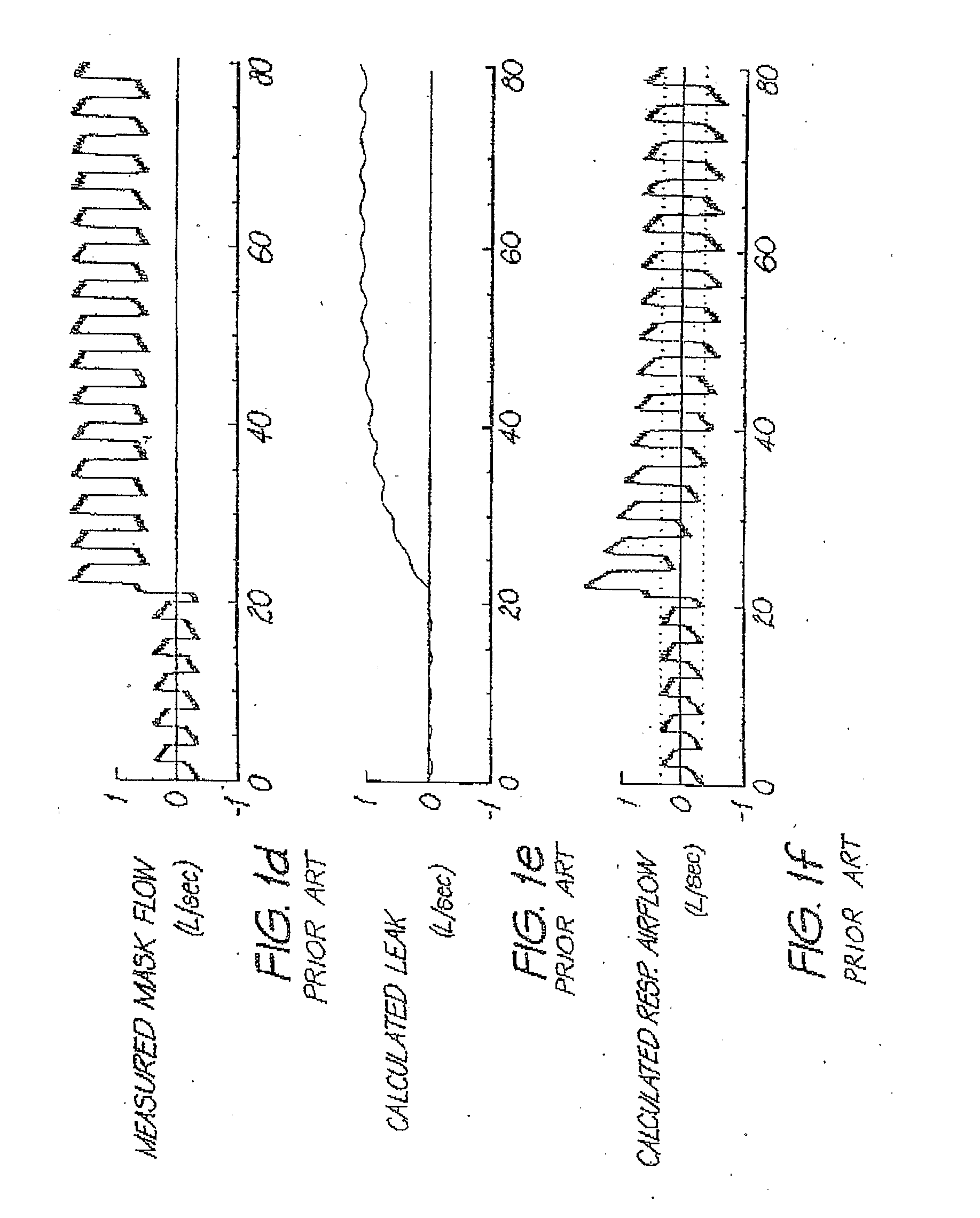 Determination of leak during cpap treatment