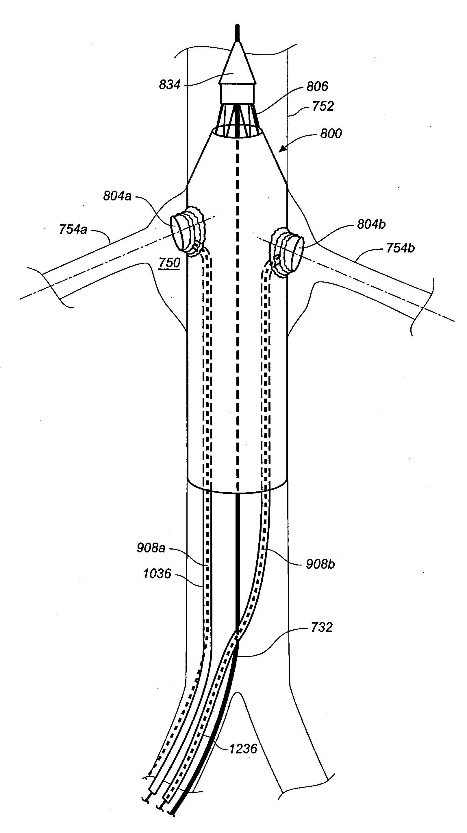 Device and Method for Controlling the Positioning of a Stent Graft Fenestration