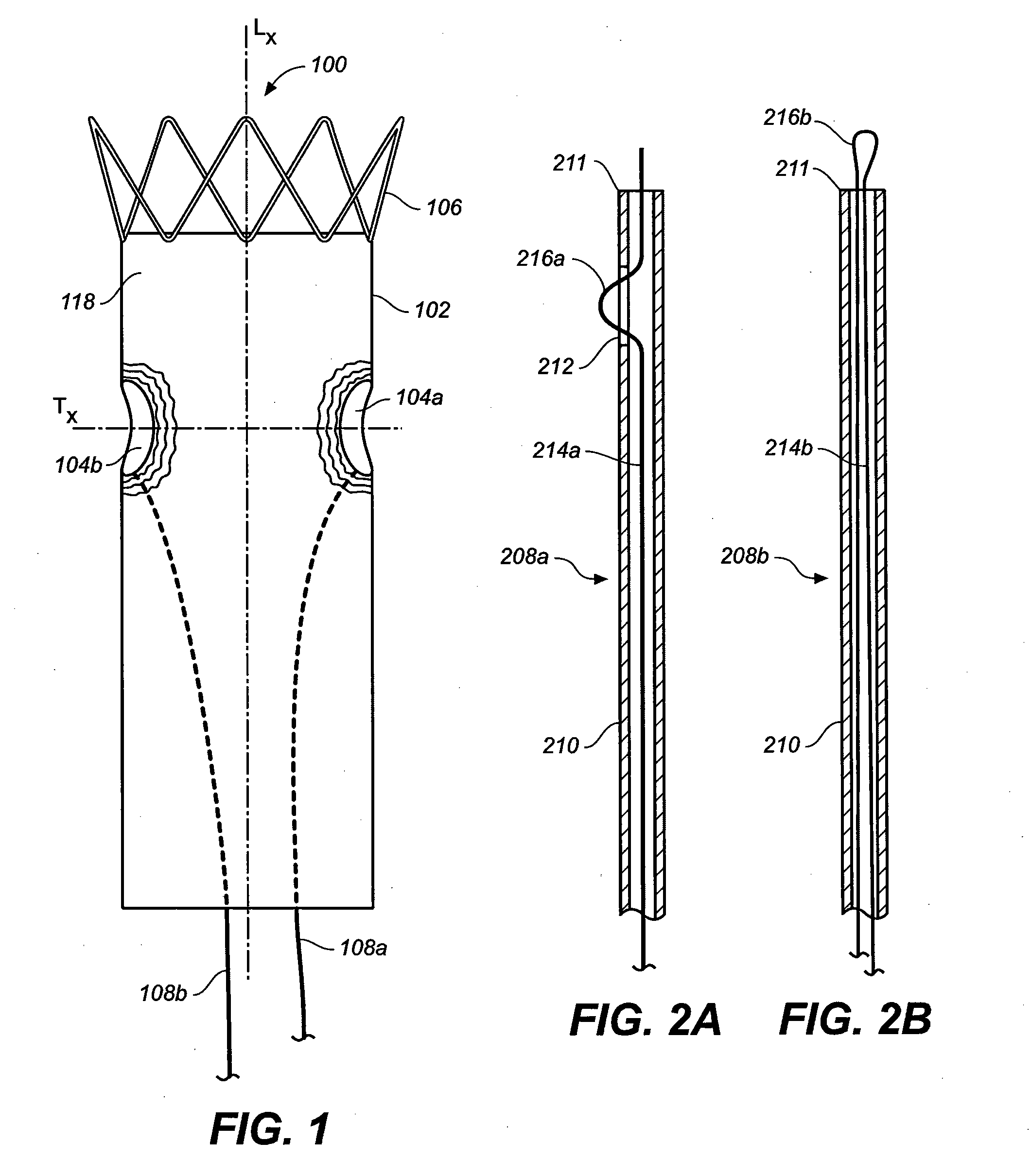 Device and Method for Controlling the Positioning of a Stent Graft Fenestration