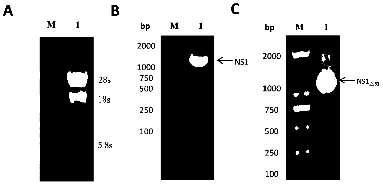 A Japanese encephalitis virus non-structural protein ns1 truncated mutant and its coding gene and application