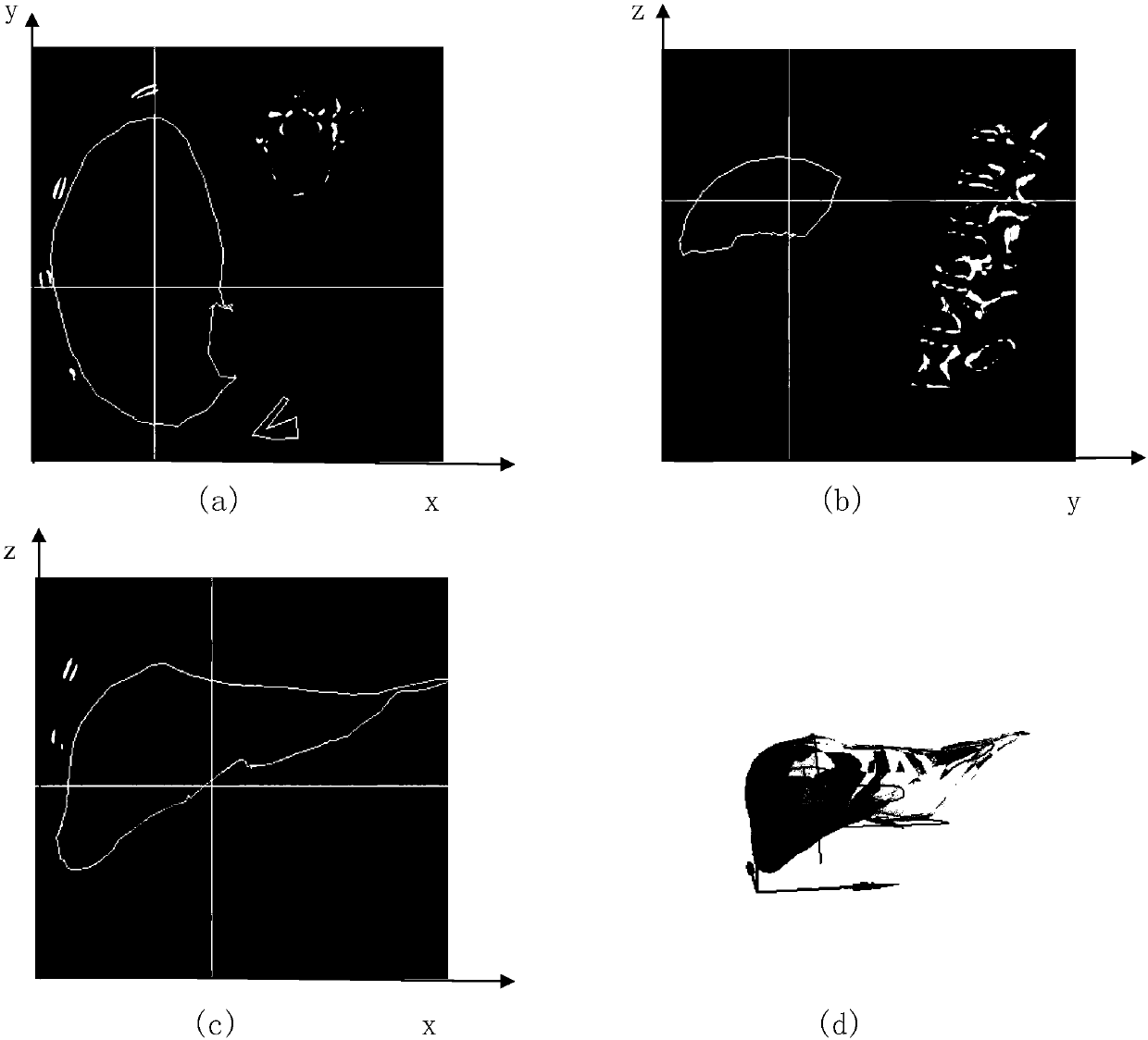 Three-dimensional medical image segmentation method based on user interaction and shape prior knowledge