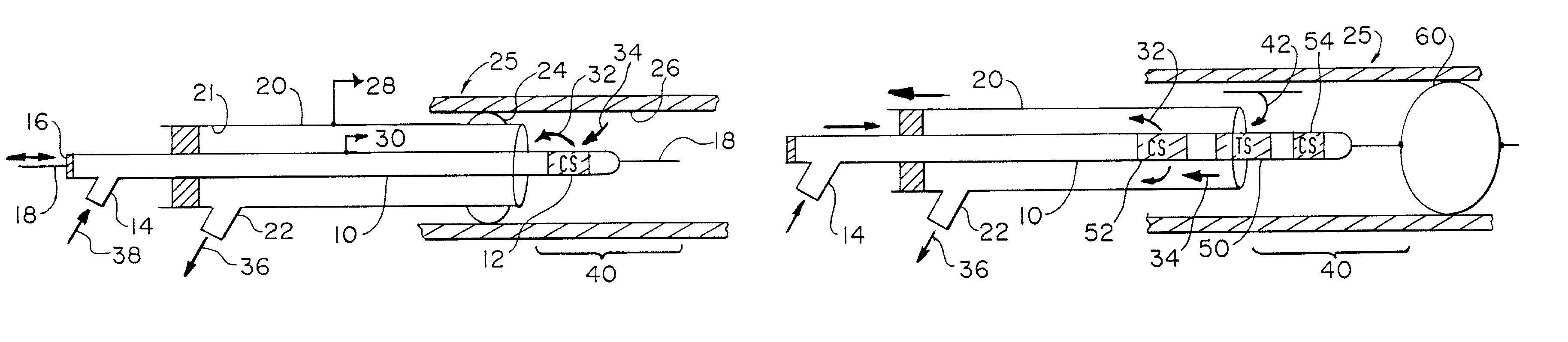 Fluidic interventional device and method of distal protection