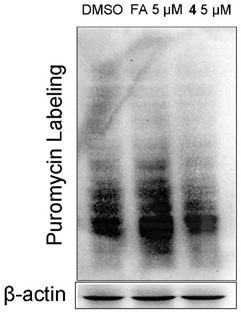 Fusidic acid derivative with anti-tumor activity and synthesis and preparation method thereof