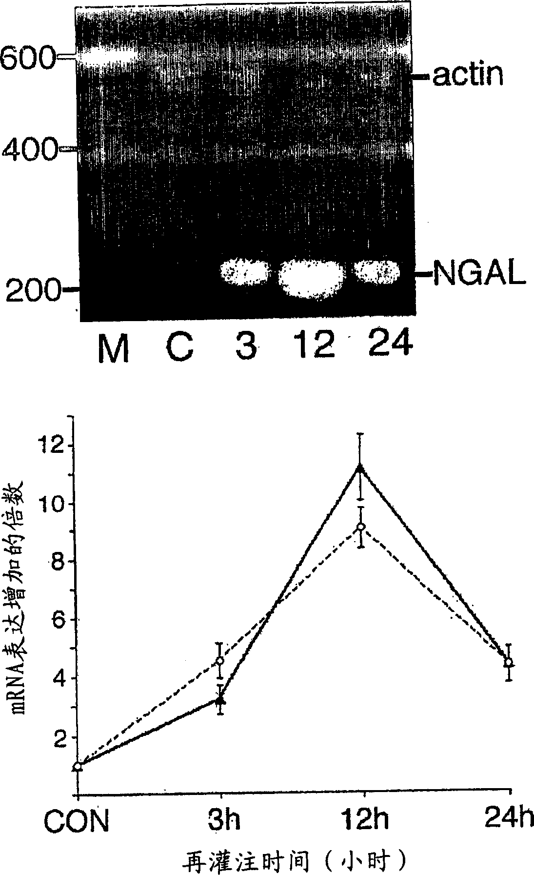 A method and kit for detecting the early onset of renal tubular cell injury