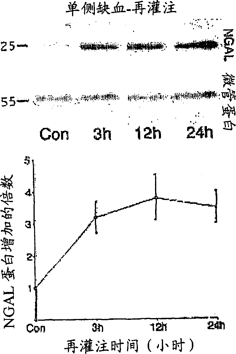 A method and kit for detecting the early onset of renal tubular cell injury