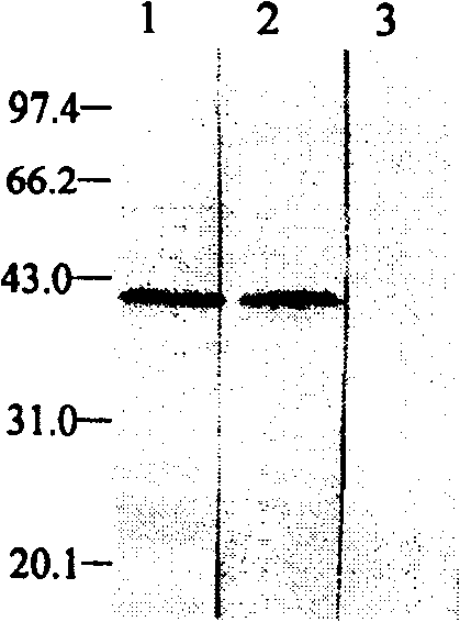 Nucleic acid vaccine, and its application