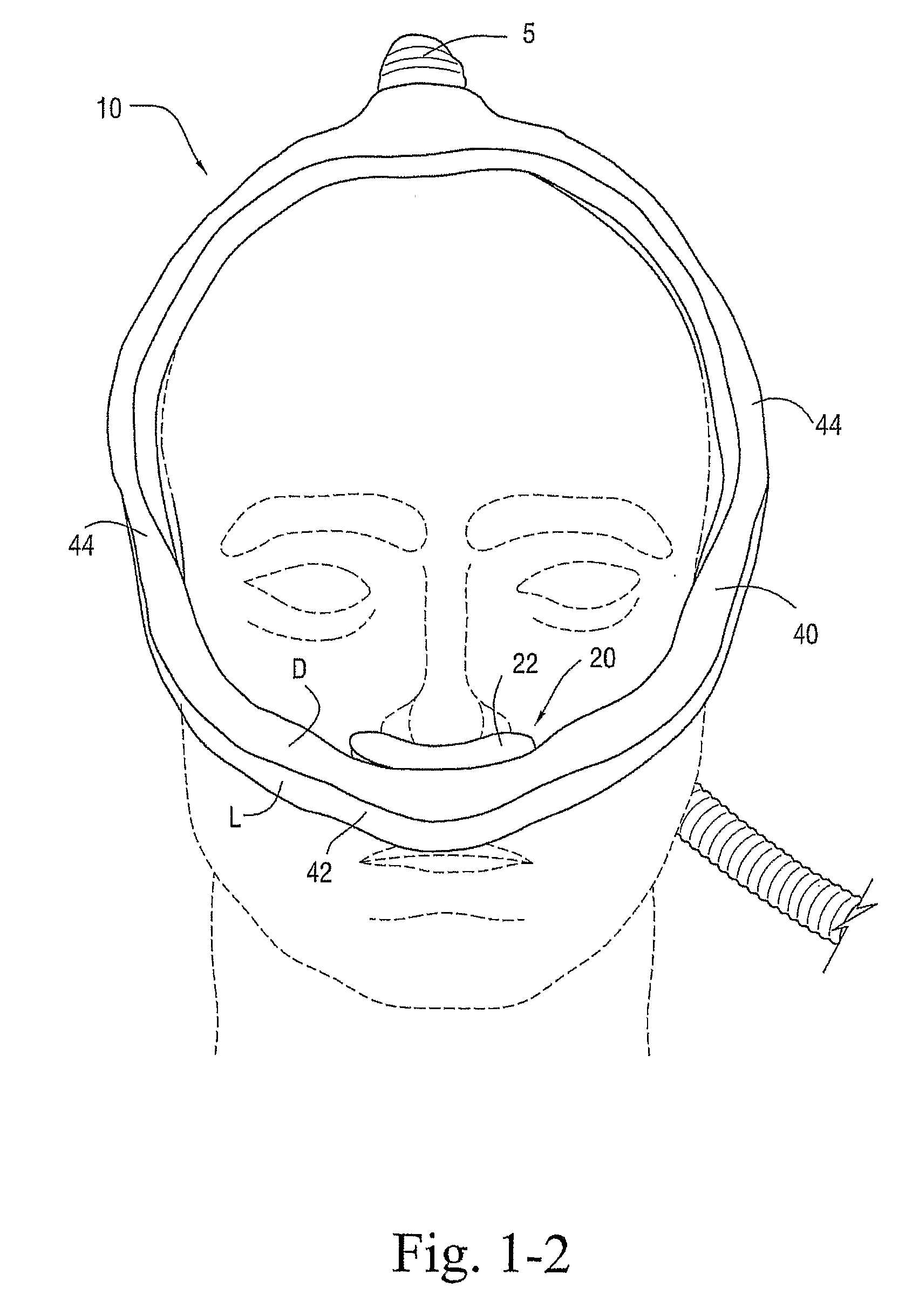 Delivery of respiratory therapy