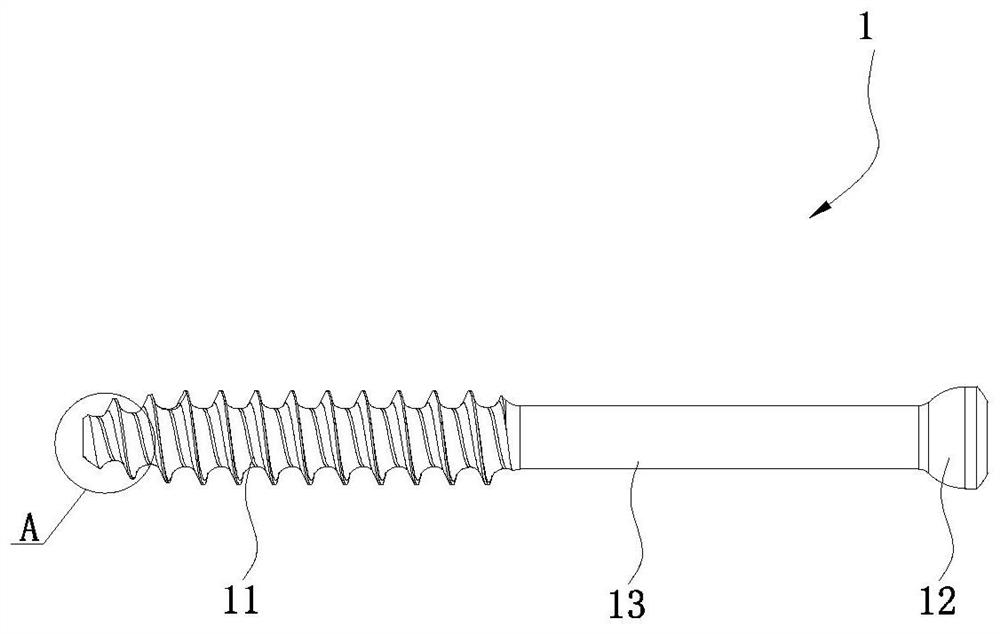 Ilium nail