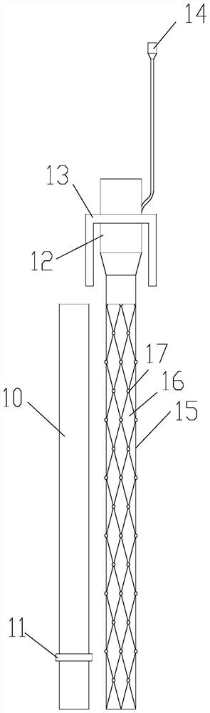 Sleeve type trachea cannula with variable pipe diameter