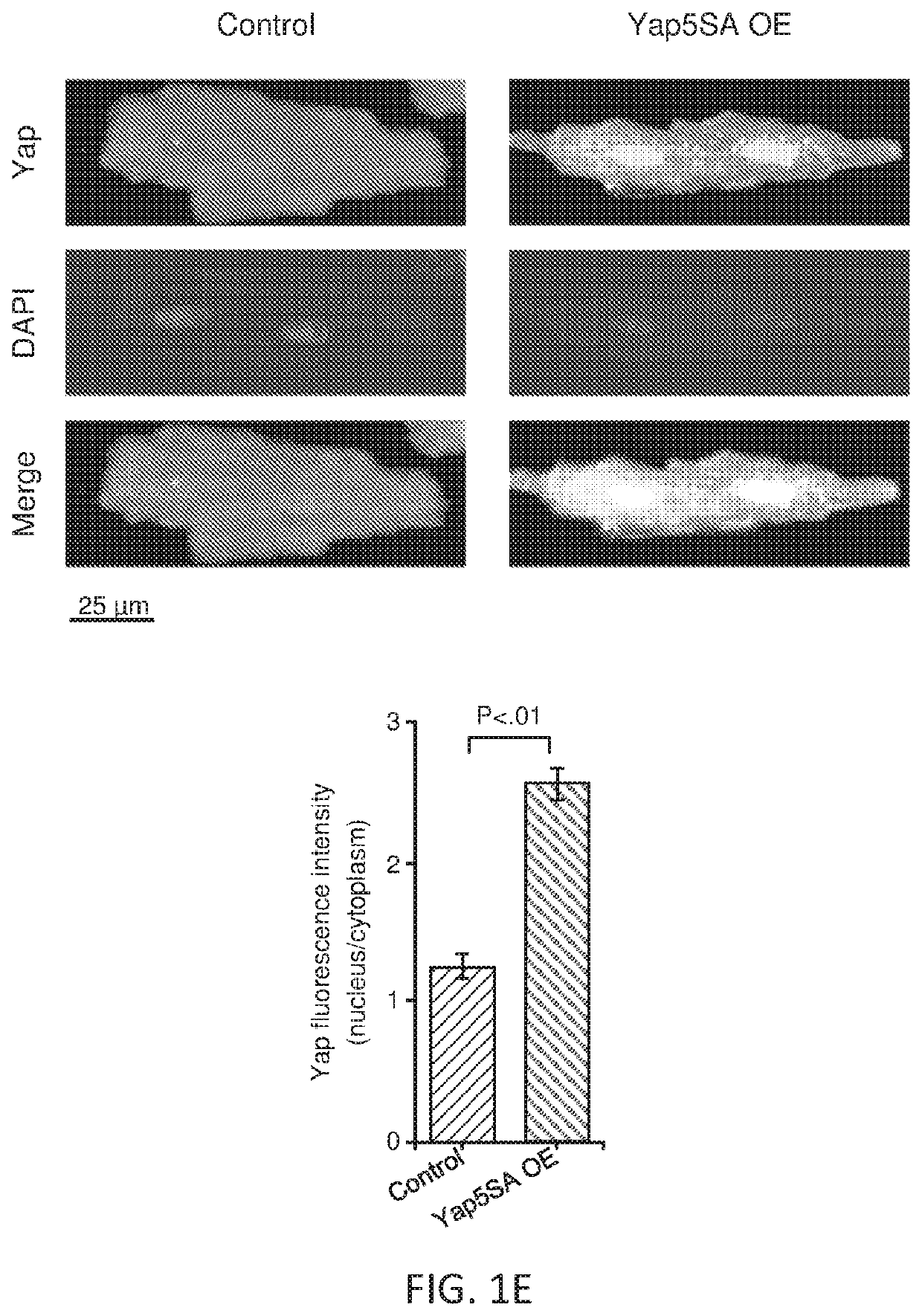 Dominant active yap, a hippo effector, induces chromatin accessibility and cardiomyocyte renewal