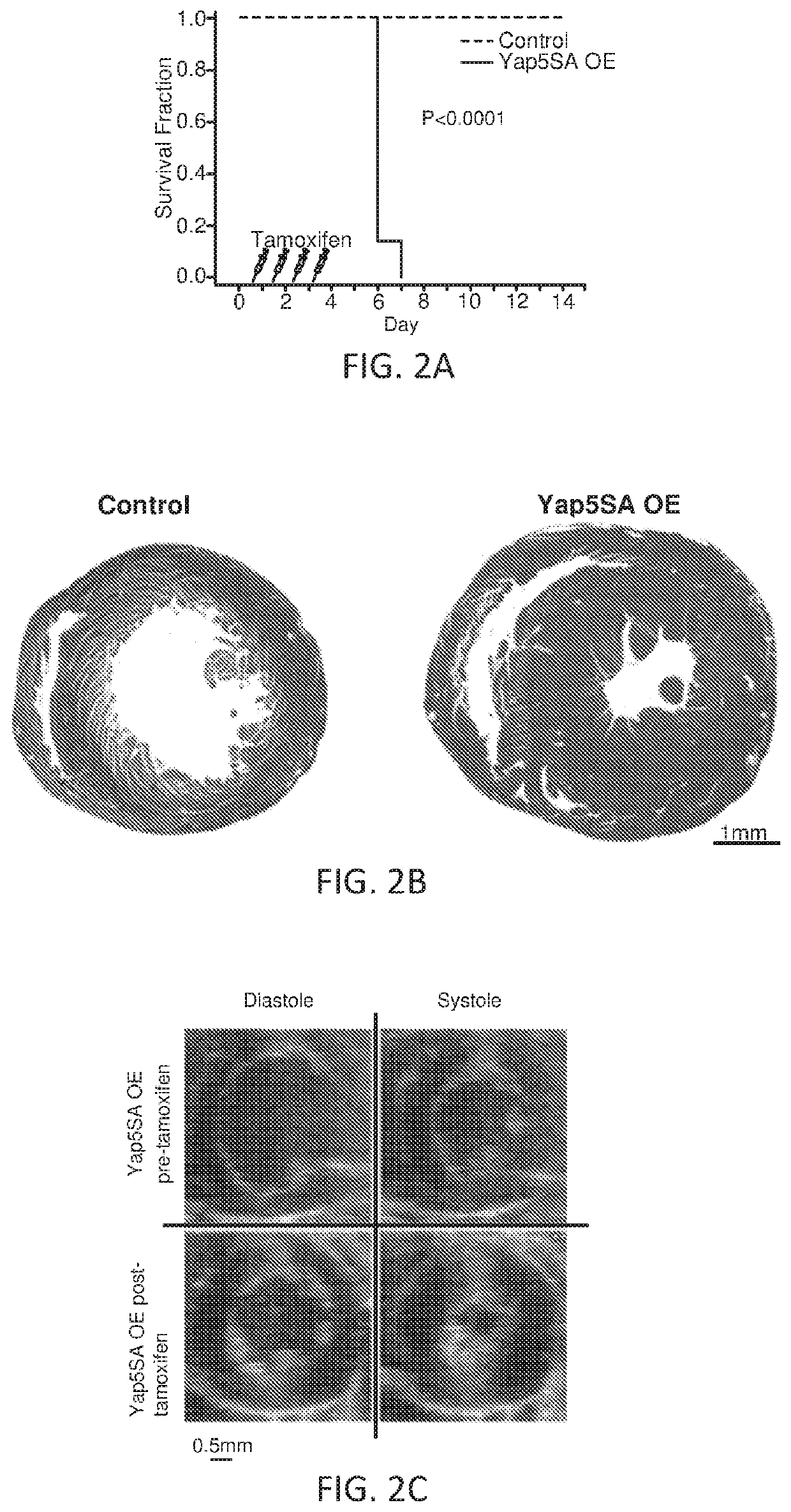 Dominant active yap, a hippo effector, induces chromatin accessibility and cardiomyocyte renewal