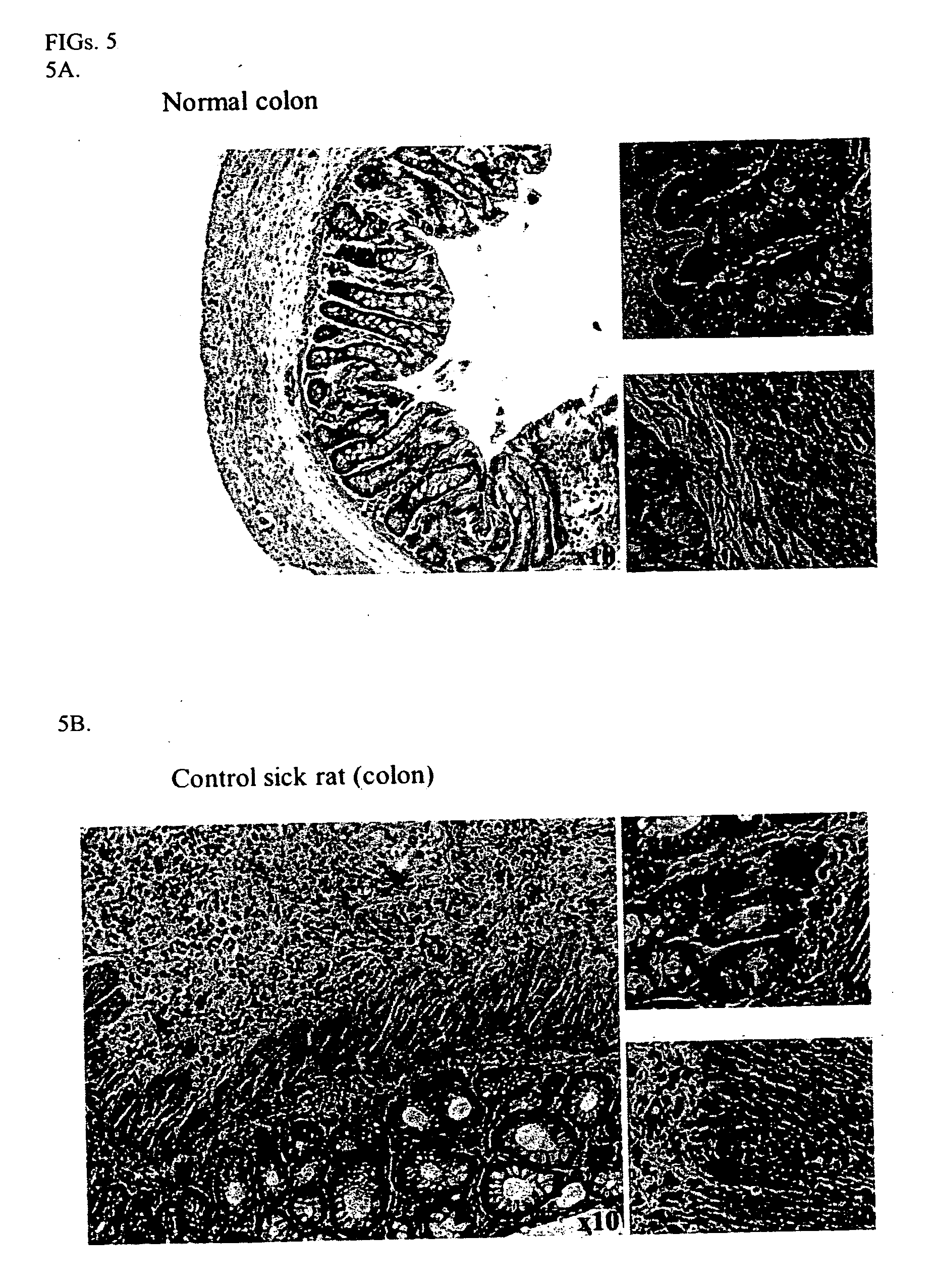 Compositions and methods for diagnosing and treating an inflammation