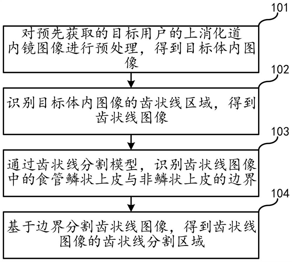 Dentate line segmentation method, device, computer equipment and storage medium