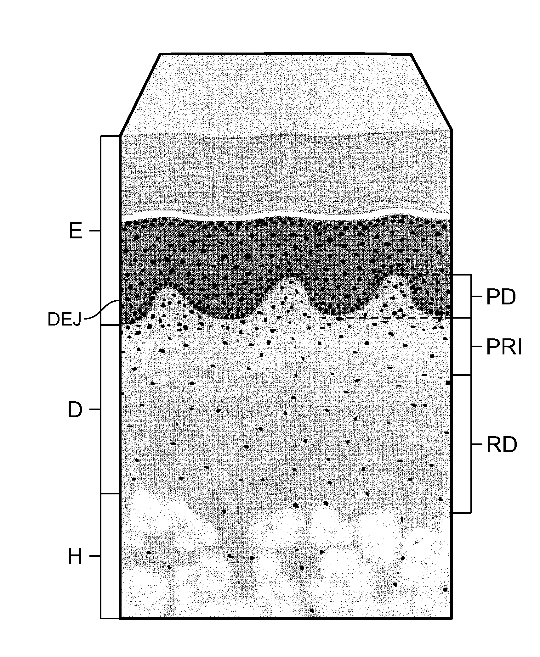 Soft tissue repair allografts and methods for preparing same