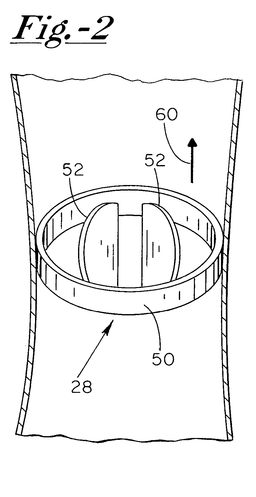 Anti-coagulation and demineralization system for conductive medical devices