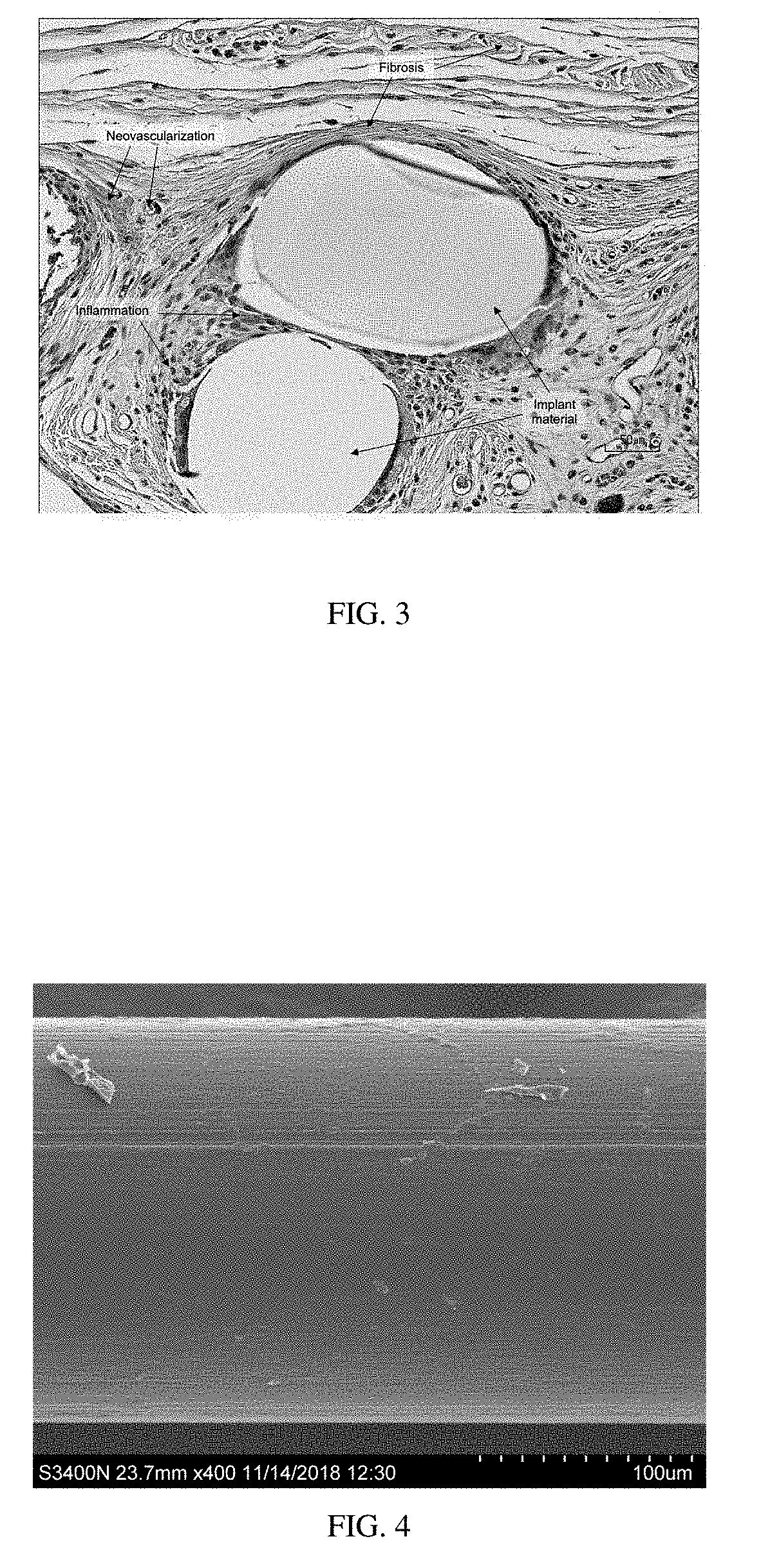 Oriented implants containing poly(butylene succinate) and copolymer, and methods of use thereof