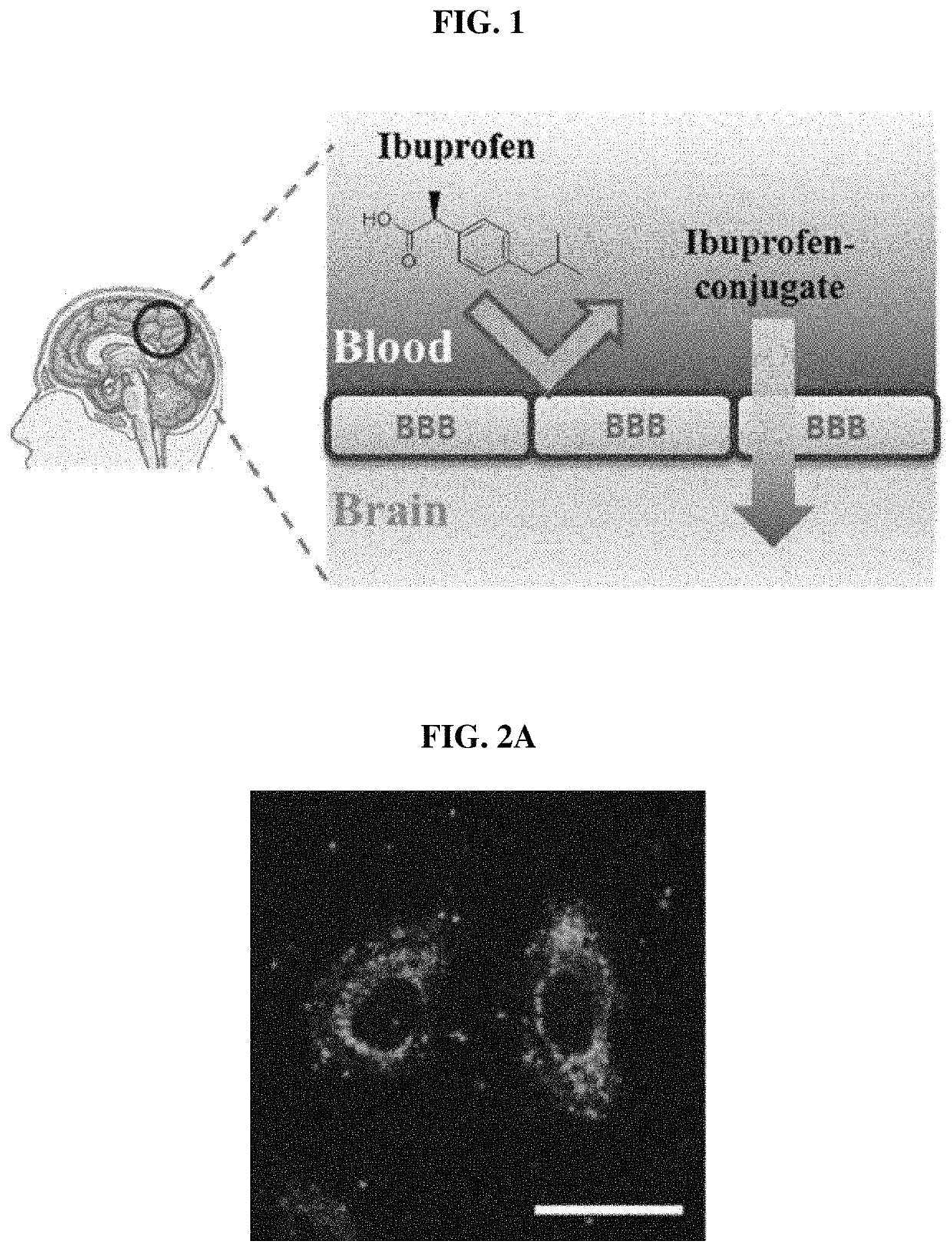 Pharmaceutical composition for preventing or treating degenerative brain disease