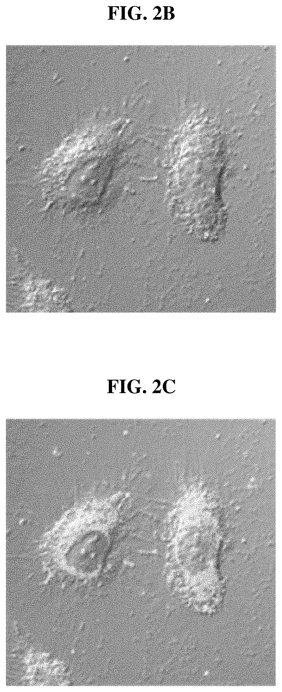 Pharmaceutical composition for preventing or treating degenerative brain disease