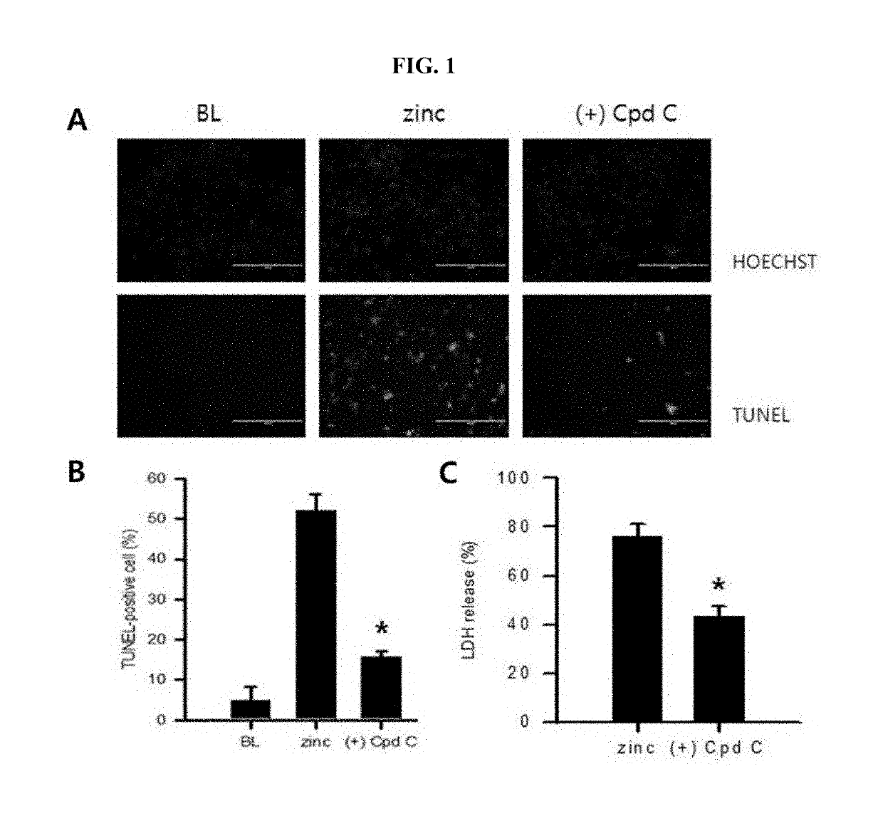 Pharmaceutical composition for stroke treatment based on ampk inhibition