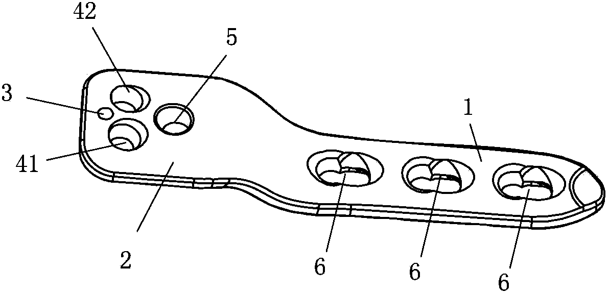 Locking plate for infantile osteotomy