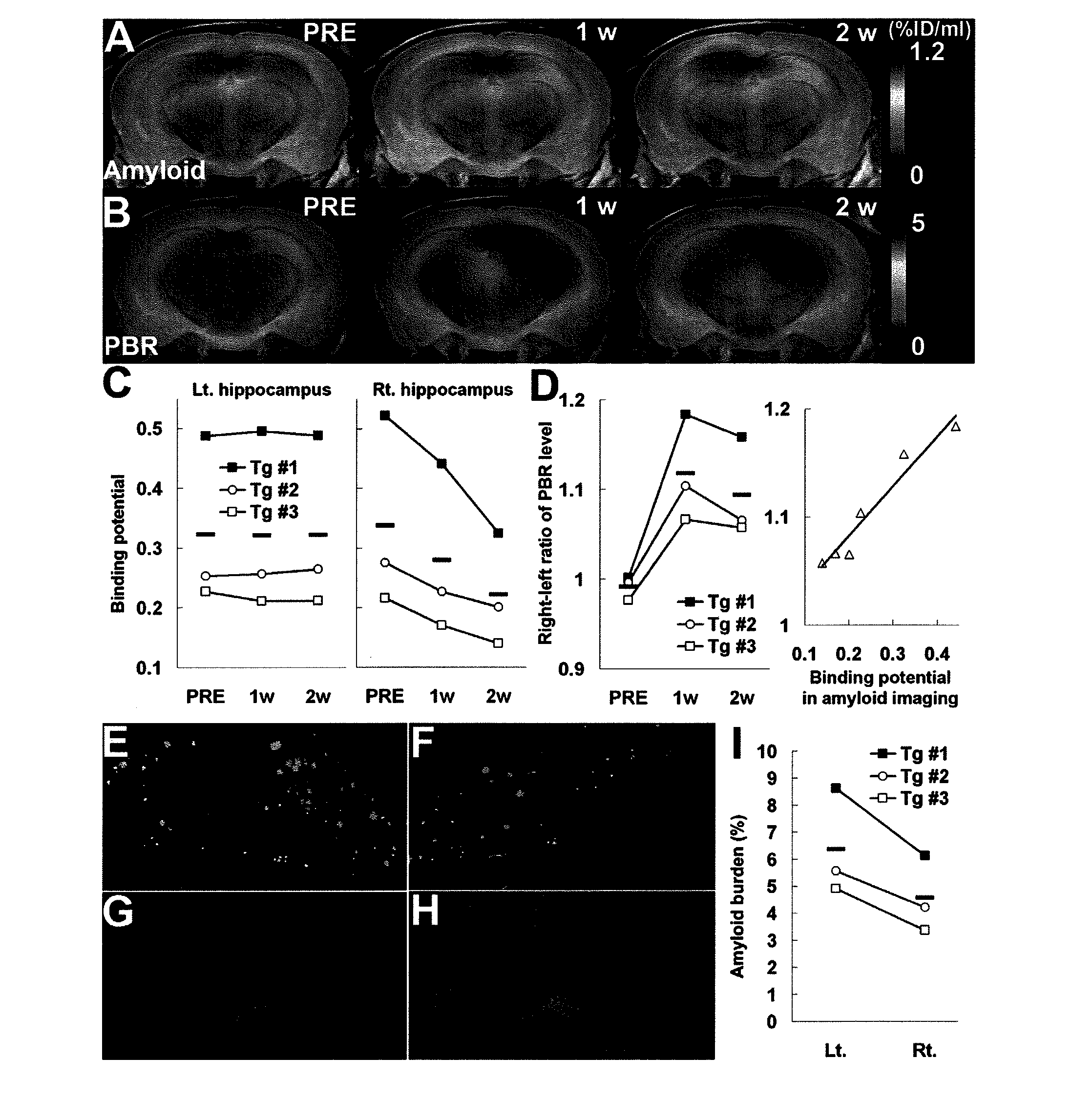 Pet visualization of amyloid-associated neuroinflammation in the brain