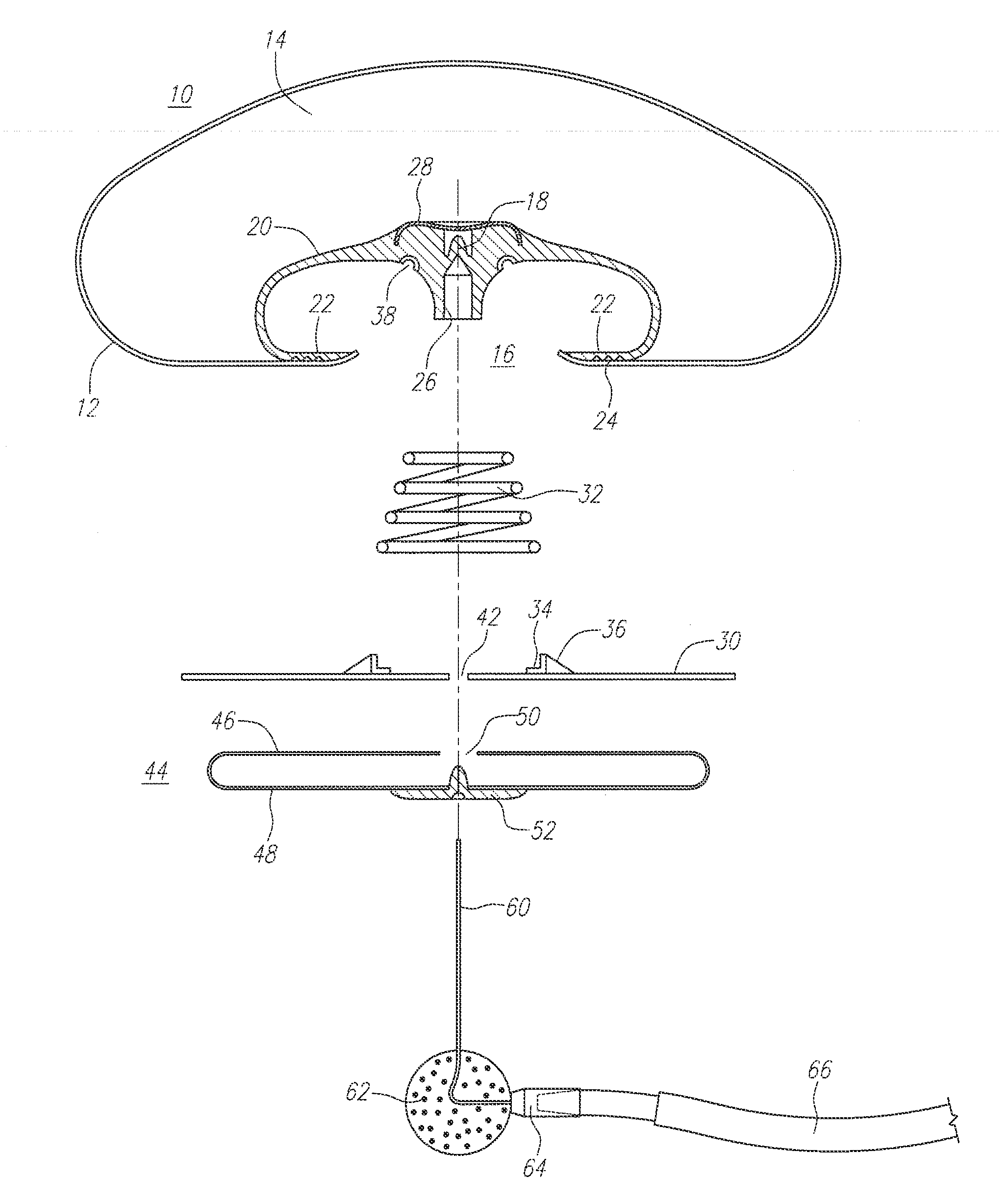 Gel-simulating and modulating buttress prosthesis