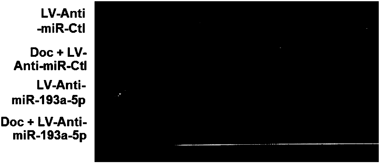 Application of miR-193a-5p antagonist or medicine composition of miR-193a-5p antagonist