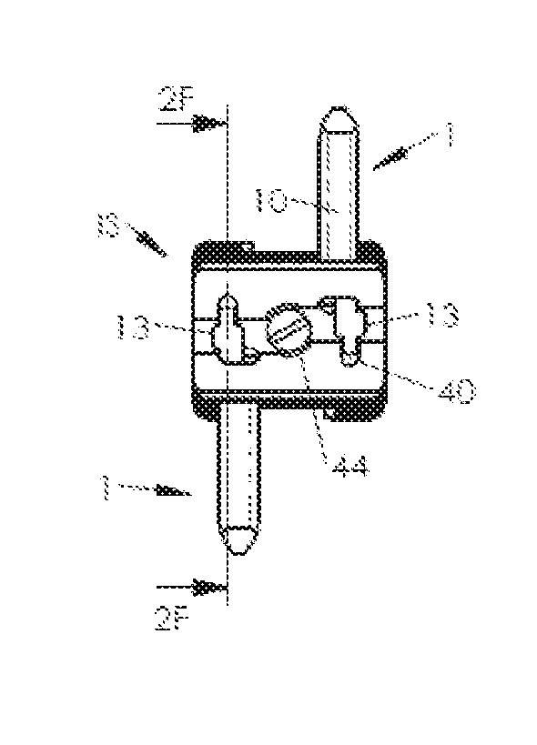 System of spinal arthodesis implants