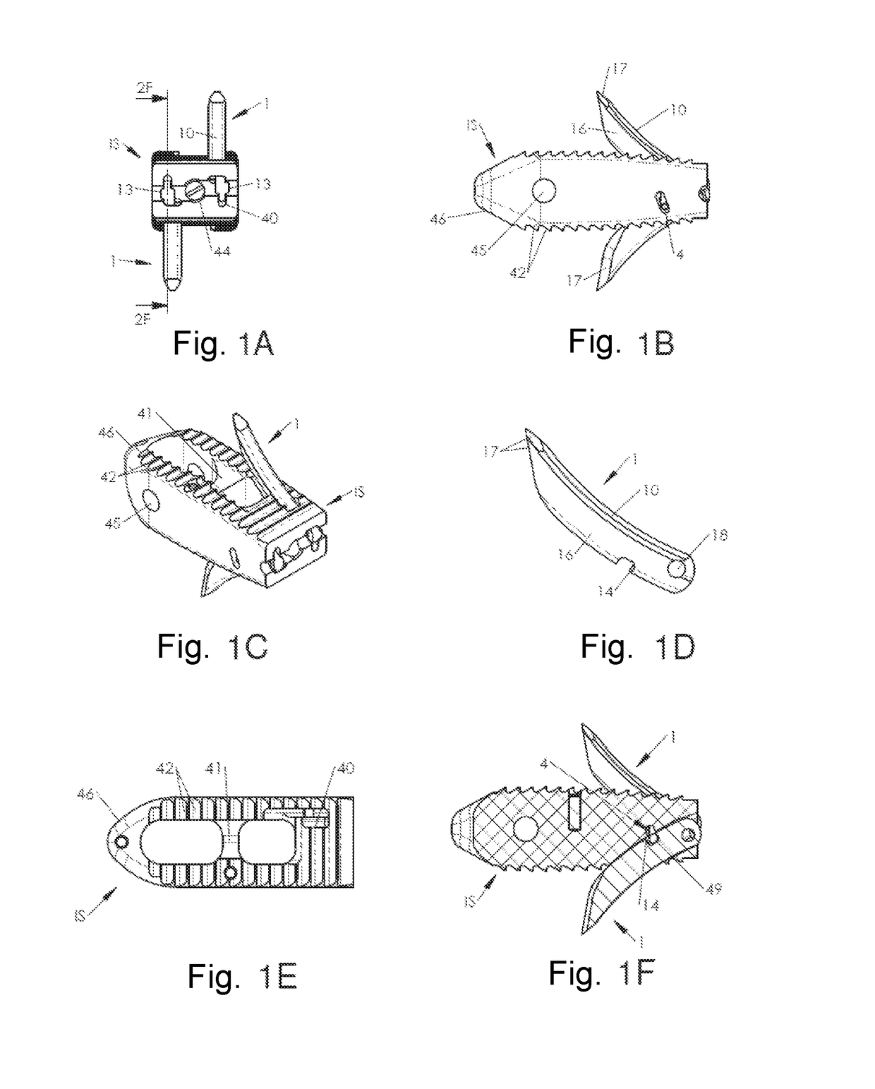 System of spinal arthodesis implants