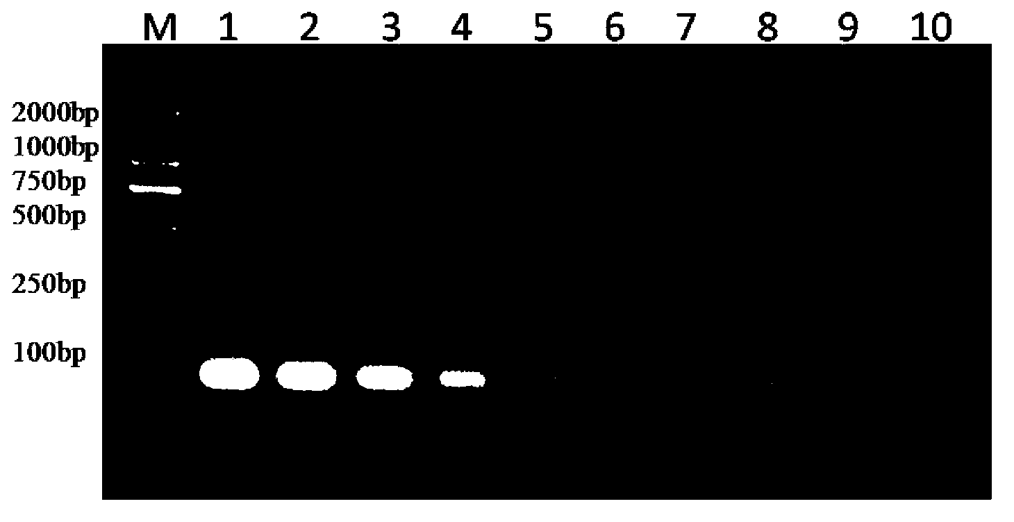 Nested RT-PCR(reverse transcription-polymerase chain reaction)kit and method for detecting porcine Kobuvirus