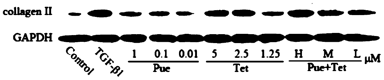 Medicinal composition for inducing stem cells to differentiate into cartilage and application of medicinal composition