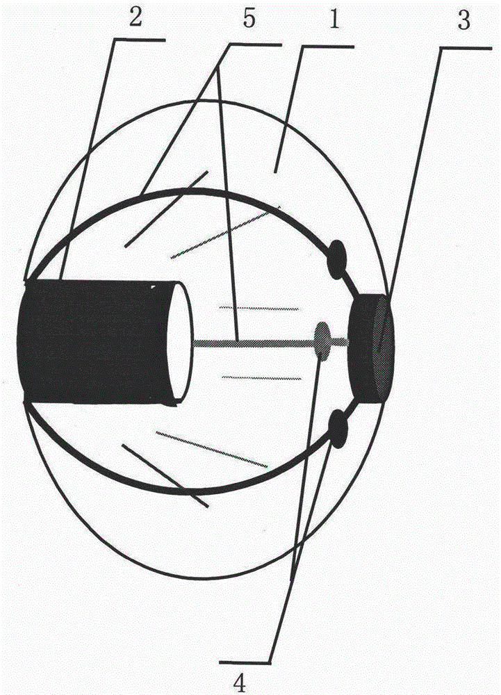 Vascular lens-end balloon for arhythmia radiofrequency ablation