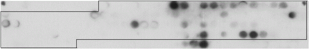 LppZ antibody identified antigen polypeptide and application thereof