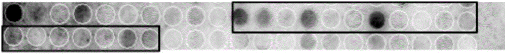 LppZ antibody identified antigen polypeptide and application thereof