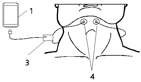 Electric stimulation snore stopper based on smart phone control and working principle and operation mode thereof