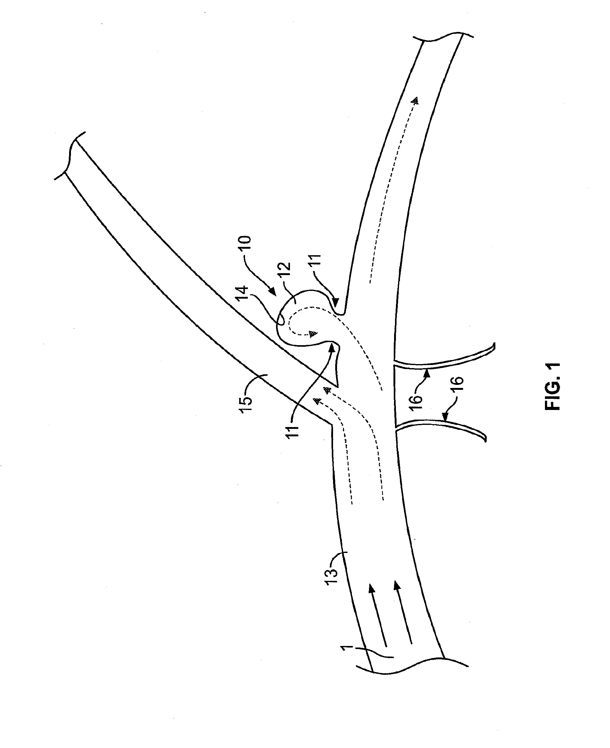 Flexible vascular occluding device