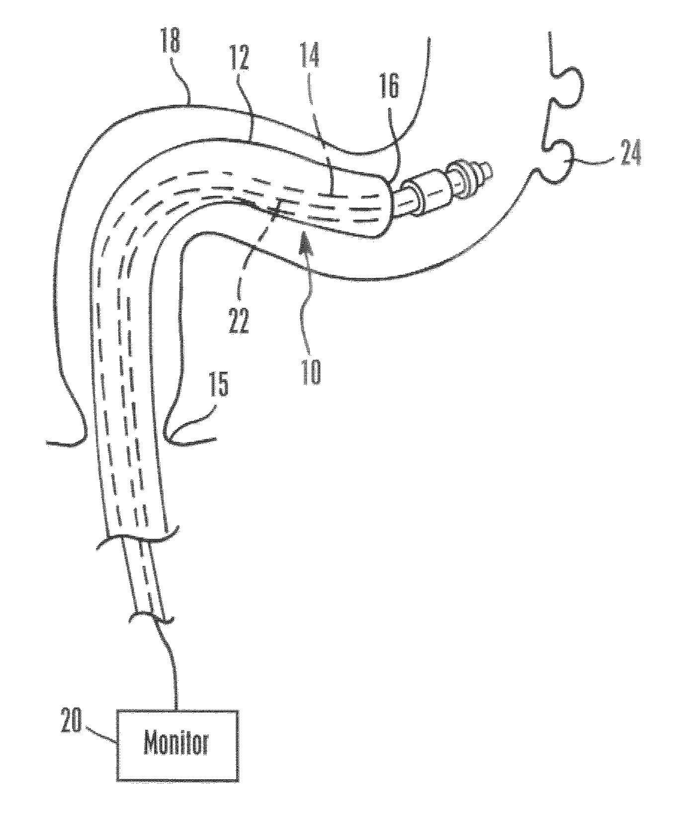 Devices and methods for securing tissue