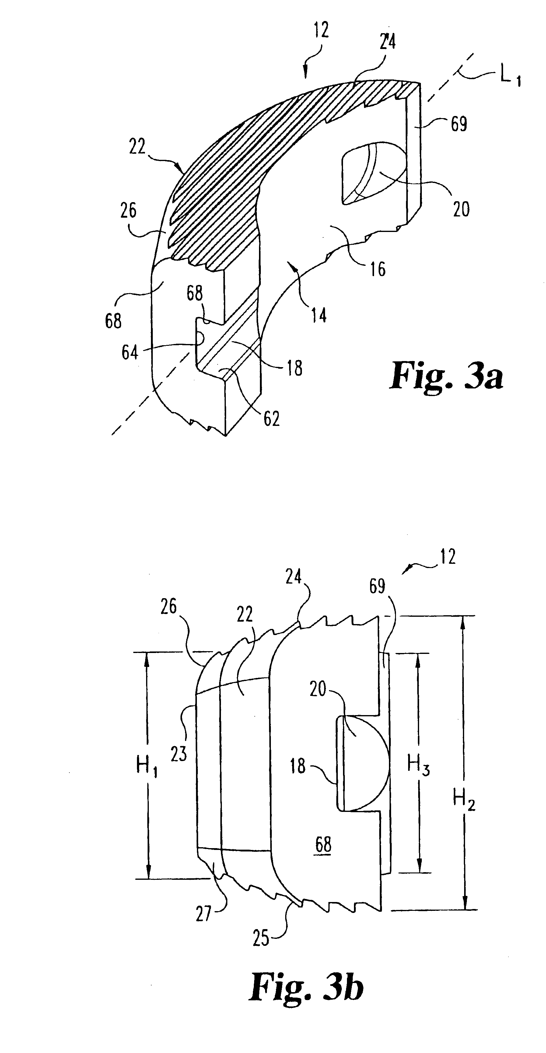 Modular interbody fusion implant